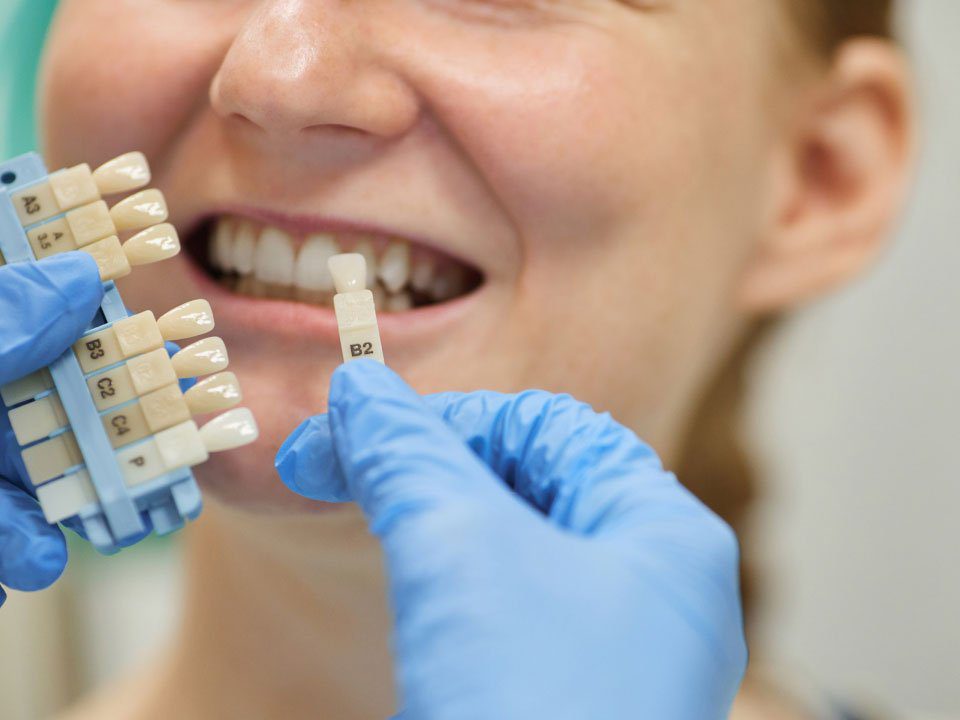 Teeth Whitening in Dental clinic, at Lifeway Specialized Medical Centre, Sharjah