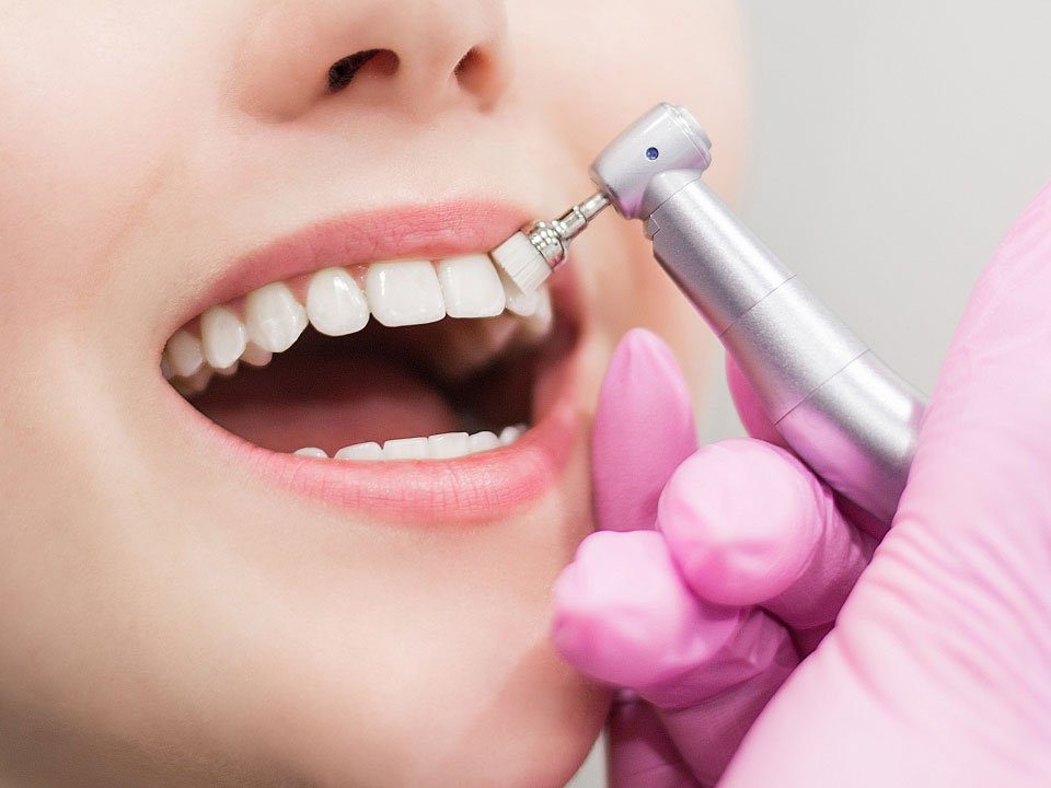 Teeth cleaning in dental clinic, at lifeway specialized medical centre, sharjah
