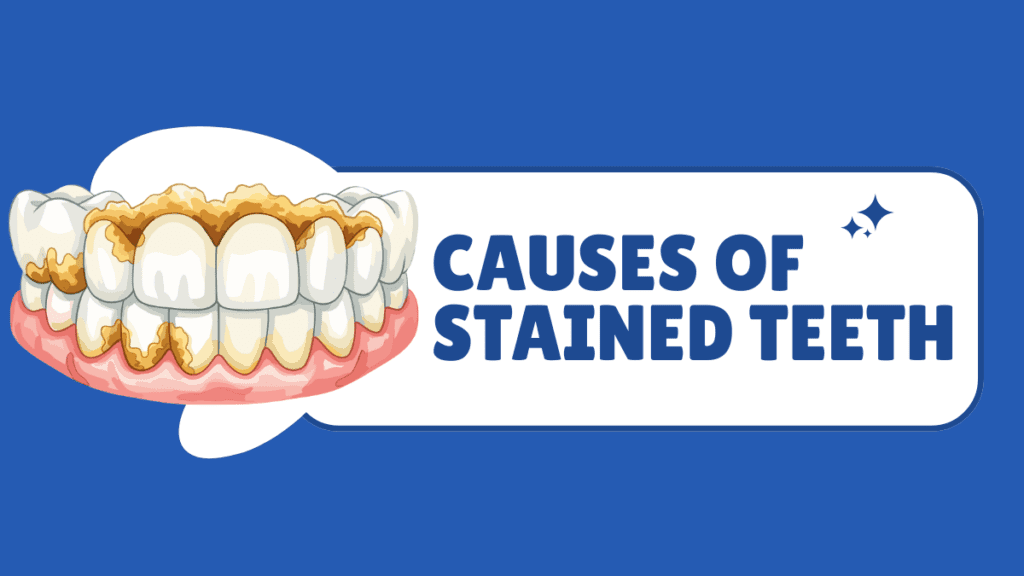 Causes of Stained Teeth